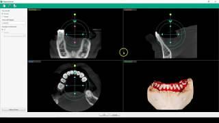 Software Ez3D-i : Allineamento file stl