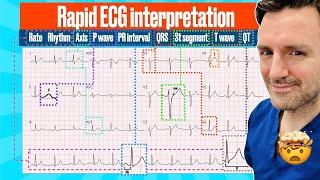 Rapid, structured ECG interpretation: A visual guide FOR REVISION!! #electrocardiogram