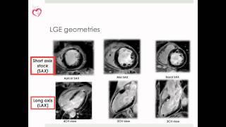 Why CMR: Introduction into LGE