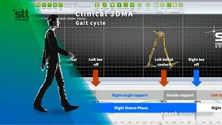 Gait cycle with Clinical 3DMA