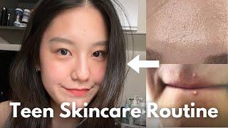 How to Create Your Own Skincare Routine for Teens (affordable & simple) I Teen Korean Skincare