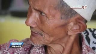 Warga Aceh Barat Susah Cari Pengobatan