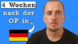 4 Wochen nach Svens Haartransplantation in Deutschland | Erfahrung