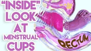 An "Inside" Look at Menstrual Cups