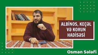 Albinos, keçəl və korun hadisəsi | @OsmanSelefi | Osman Sələfi