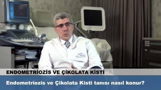 Endometriozis ve Çikolata Kisti tanısı nasıl konur?