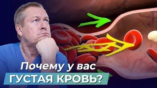 У вас ГУСТАЯ КРОВЬ? Узнайте всю ПРАВДУ о свертываемости крови и её густоте | Мифы медицины