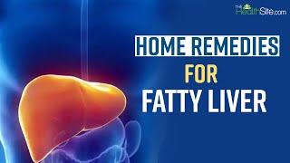 Fatty Liver Home Remedies: Fatty Liver Treatment | Fatty Liver Symptoms | Fatty Liver Diet