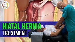 Hiatal Hernia Treatment |  Synergy Wellness Chiropractic & Physical Therapy PLLC