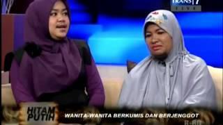 Hitam Putih Wanita Berjenggot dan Berkumis Part 1