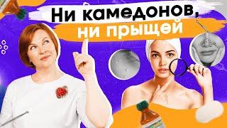 Комедоны и прыщи. Как от них избавиться? Мнение косметолога.