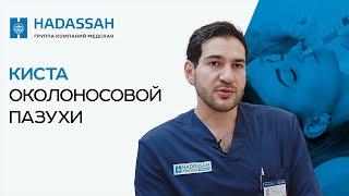 Лечение кисты гайморовой пазухи: диагностика и лечение / Hadassah Medical Moscow