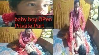 #vlog_31# बेबी बॉय के प्राइवेट पार्ट को कैसे खोलें         How to OPen Baby Boy Private Part