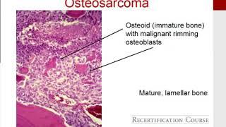 MILLER'S 2016 Orthopaedics: Orthopaedic Oncology