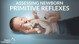 "Assessing Newborn Primitive Reflexes" by Nina Gold for OPENPediatrics