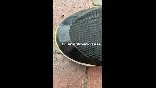 Crusty Toes #trending #funnyrandommemes #internetmemes #viral #edit #trendingmemes #toes #crusty