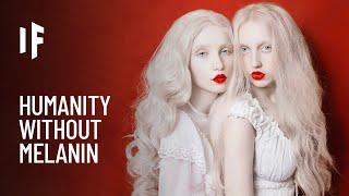 What If Everyone Was Albino?