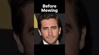 Mewing Transformation