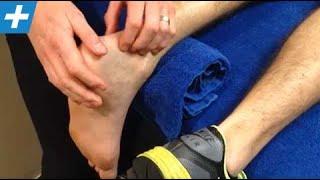 Achilles tendon rupture - week 6 post-op surgical repair | Feat. Tim Keeley | No.56 | Physio REHAB