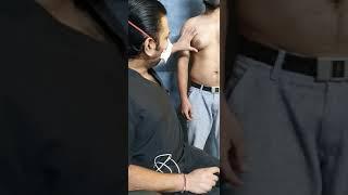 Grade 3A Gynecomastia की 30 सेकण्ड्स में Explanation. Details in Next Video