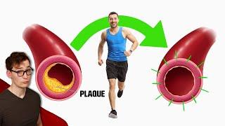 Exercise shrinks Plaque, but it does more than that…