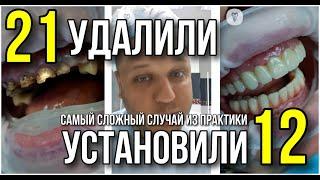 Самый сложный случай из практики. Имплантация зубов.