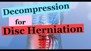 Chiropractic Lower back DECOMPRESSION and FULL SPINE pelvic and midback adjustment