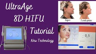 NON Surgical FACE LIFT!!!  LOOK YEARS YOUNGER!!  UltraAge 8D HIFU  2022 NEW TECHNOLOGY