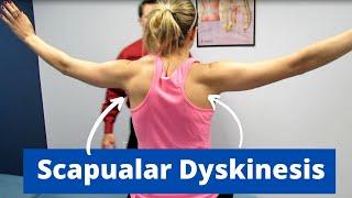 Scapular Dyskinesis Bilaterally