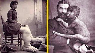 A Brief "Dark" History Of Freak Shows