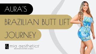 Brazilian Butt Lift Journey at Mia Aesthetics