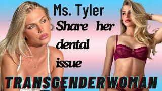 This beautiful Transgenderwoman shared her small  dental problem