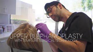 Upper Blepharoplasty with TempSure Surgical by Dr. Kian Karimi