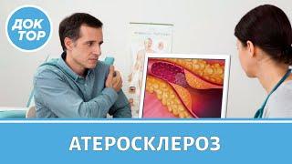 Атеросклероз | Когда делать операцию