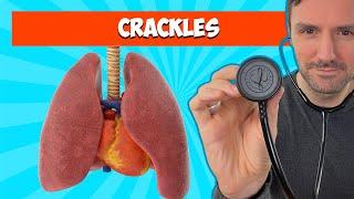 Fine and Coarse Crackles: Lung Sounds For Beginners 