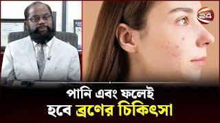 ব্রণ কেন হয়, এর চিকিৎসা কী? | Pimple Treatment | Channel 24