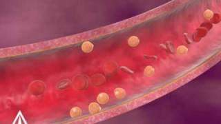 Cholesterol - 3D Medical Animation