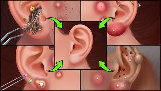 ASMR Happy Hospital - Treatment of the ear - Appointment with an otolaryngologist