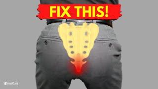 How to Fix Tailbone Pain for Good