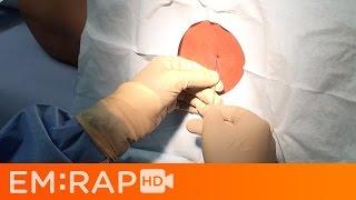 Lumbar Puncture Tutorial