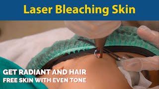 Laser Bleaching Skin Treatment  | Laser Treatment For Instant Skin Tone Lightening & Radiant Skin