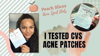 I Tested PEACH SLICES Acne Patches