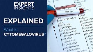 Expert Insights: What is cytomegalovirus (CMV)?