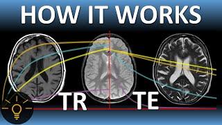 TR, TE & MRI Image Weighting (T1, T2, PD) EXPLAINED | MRI Physics Course Lecture 7