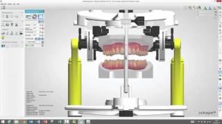 How to use the Virtual Articulator in Ortho Analyzer - powered by R+K CADCAM Berlin