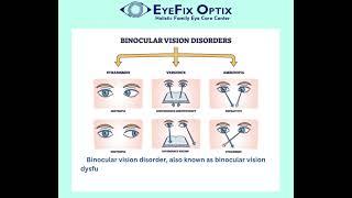 What is Binocular Vision Dysfunction