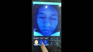 Magic Mirror Max--skin analyzer