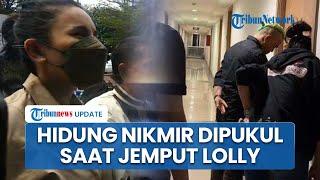 Hidung Nikita Mirzani Kena Pukul saat JempuT Paksa Lolly, Nikmir: Sedikit Luka Aja, Enggak Masalah