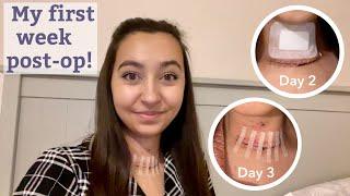 Thyroid Surgery Recovery vlog! | Day 2, 3, 4 & 6 Post-op | week 1