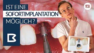 ZahnIMPLANTAT SOFORT? Zahn raus, Implantat rein? Ist das möglich?